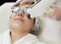 Hyperpigmentation Laser Treatment